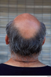 Head Hair Man White Sports Average Bald Street photo references